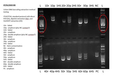 how to read a pcr gel|How to Interpret DNA Gel Electrophoresis Results .